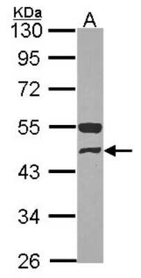 Western Blot: GCDH Antibody [NBP2-16622]