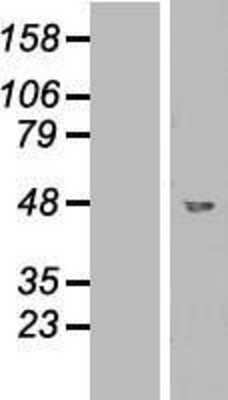 Western Blot: GCDH Overexpression Lysate [NBL1-11003]