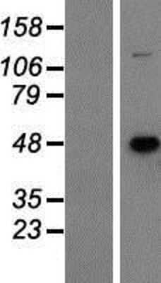 Western Blot: GCDH Overexpression Lysate [NBP2-07400]