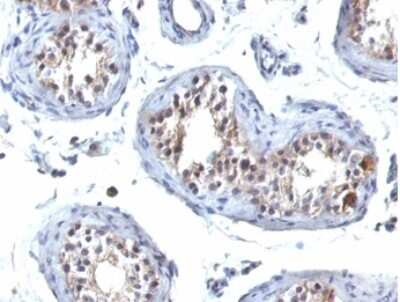 Immunohistochemistry-Paraffin: GCET2 Antibody (HGAL/830) [NBP3-13919]