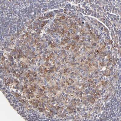 Immunohistochemistry-Paraffin: GCET2 Antibody [NBP1-82693]