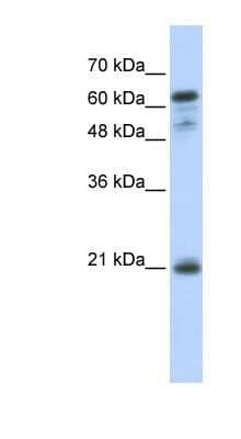 Western Blot: GCET2 Antibody [NBP1-54596]