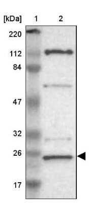 Western Blot: GCET2 Antibody [NBP1-82693]