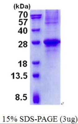 SDS-PAGE: Recombinant Human GCET2 His Protein [NBP2-23075]