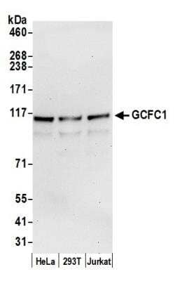 Western Blot: GCFC1 Antibody [NBP1-71921]