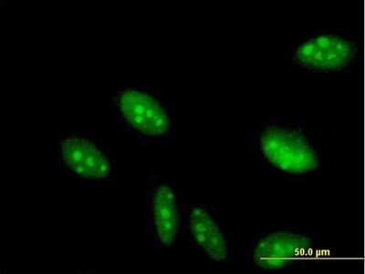 Immunocytochemistry/ Immunofluorescence: GCFC2 Antibody [H00006936-B01P]