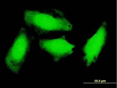 Immunocytochemistry/ Immunofluorescence: GCH1 Antibody (1F5) [H00002643-M03]