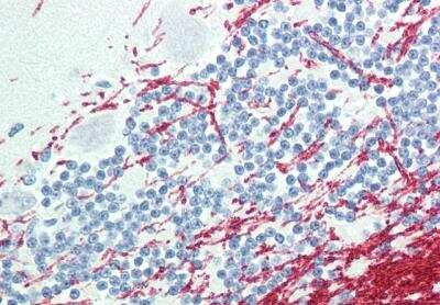 Immunohistochemistry: GCH1 Antibody [NBP1-20923]