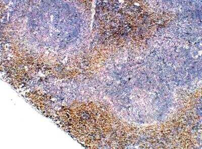 Immunohistochemistry-Paraffin: GCH1 Antibody [NBP3-12307]