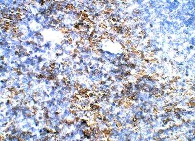 Immunohistochemistry-Paraffin: GCH1 Antibody [NBP3-12307]