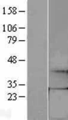 Western Blot: GCH1 Overexpression Lysate [NBL1-11007]