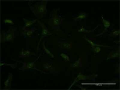 Immunocytochemistry/ Immunofluorescence: GCHFR Antibody (4G6) [H00002644-M01]