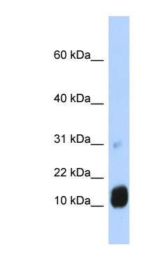 Western Blot: GCHFR Antibody [NBP1-54960]