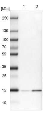 Western Blot: GCHFR Antibody [NBP1-91931]