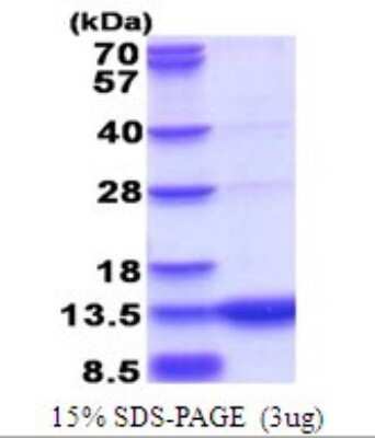 SDS-PAGE: Recombinant Human GCHFR His Protein [NBP2-51750]