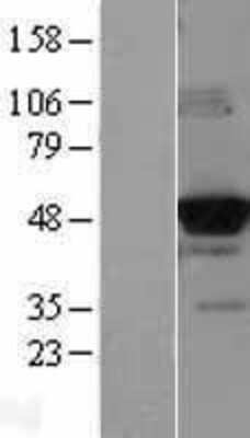 Western Blot: Glucokinase/GCK Overexpression Lysate [NBL1-11008]