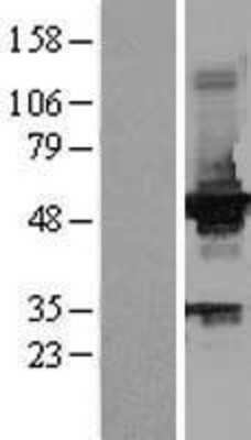 Western Blot: Glucokinase/GCK Overexpression Lysate [NBL1-11009]