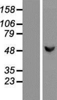 Western Blot: Glucokinase/GCK Overexpression Lysate [NBP2-09947]