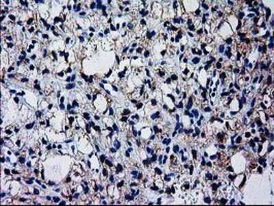 Immunohistochemistry-Paraffin: GCKR Antibody (OTI1E7) [NBP2-03396]