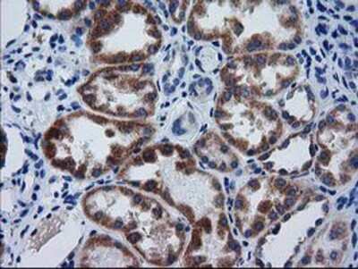 Immunohistochemistry-Paraffin: GCKR Antibody (OTI1E7) [NBP2-03396]