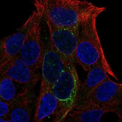 Immunocytochemistry/ Immunofluorescence: GCKR Antibody [NBP2-56132]