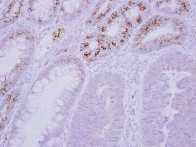 Immunohistochemistry-Paraffin: GCKR Antibody [NBP2-16623]