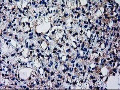 Immunohistochemistry: GCKR Antibody (OTI1E7) - Azide and BSA Free [NBP2-70823]