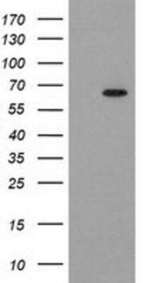 Western Blot: GCKR Antibody (OTI1E7)Azide and BSA Free [NBP2-70823]