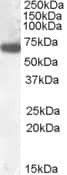 Western Blot: GCKR Antibody [NBP1-28910]