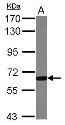 Western Blot: GCKR Antibody [NBP2-16623]