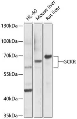 Western Blot: GCKR AntibodyBSA Free [NBP3-04639]