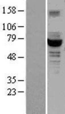 Western Blot: GCKR Overexpression Lysate [NBL1-11010]