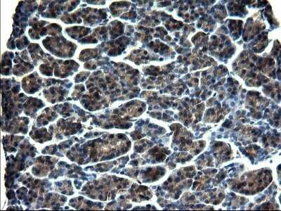 Immunohistochemistry: GCLC Antibody (OTI1A3) [NBP2-45830]