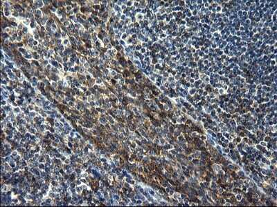 Immunohistochemistry: GCLC Antibody (OTI1A3) [NBP2-45830]