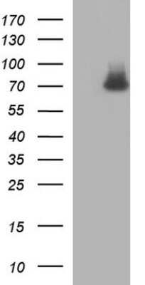 Western Blot: GCLC Antibody (OTI1A3) [NBP2-45830]