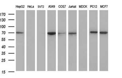 Western Blot: GCLC Antibody (OTI1A3) [NBP2-45830]