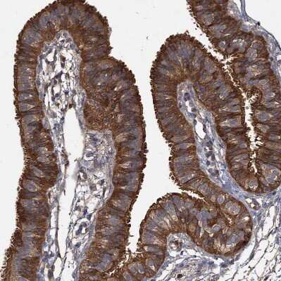 Immunohistochemistry-Paraffin: GCLC Antibody [NBP1-81840]