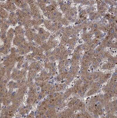 Immunohistochemistry-Paraffin: GCLC Antibody [NBP1-81840]