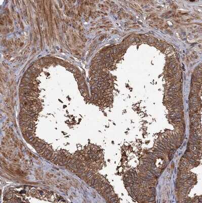 Immunohistochemistry-Paraffin: GCLC Antibody [NBP1-81840]