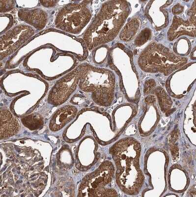 Immunohistochemistry-Paraffin: GCLC Antibody [NBP1-81840]