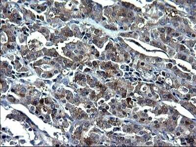 Immunohistochemistry: GCLC Antibody (OTI1A3) - Azide and BSA Free [NBP2-70830]