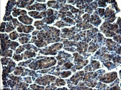 Immunohistochemistry: GCLC Antibody (OTI1A3) - Azide and BSA Free [NBP2-70830]