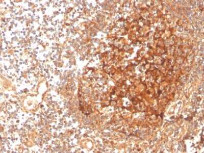 Immunohistochemistry-Paraffin: GCLM Antibody (CPTC-GCLM-1) - Azide and BSA Free [NBP3-08471]