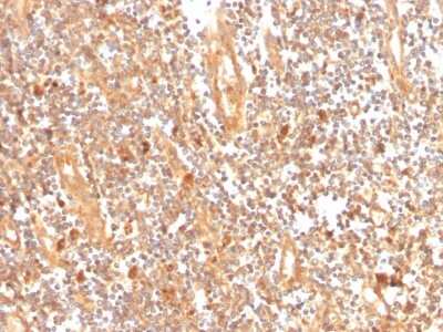 Immunohistochemistry-Paraffin: GCLM Antibody (CPTC-GCLM-1) - Azide and BSA Free [NBP3-08471]