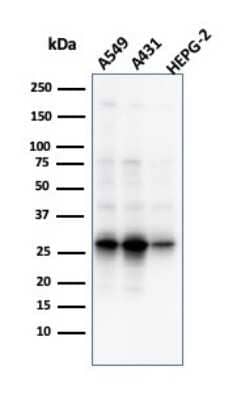 Western Blot: GCLM Antibody (CPTC-GCLM-1)Azide and BSA Free [NBP3-08471]