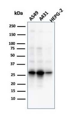 Western Blot: GCLM Antibody (CPTC-GCLM-1) [NBP3-07298]