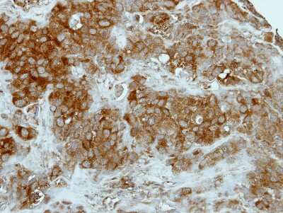 Immunohistochemistry-Paraffin: GCLM Antibody [NBP1-33405]