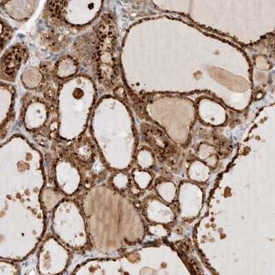 Immunohistochemistry-Paraffin: GCLM Antibody [NBP1-83361]