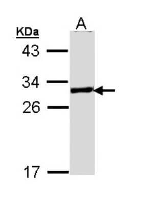 Western Blot: GCLM Antibody [NBP1-33405]
