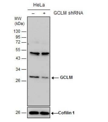 Knockout Validated: GCLM Antibody [NBP1-33405]